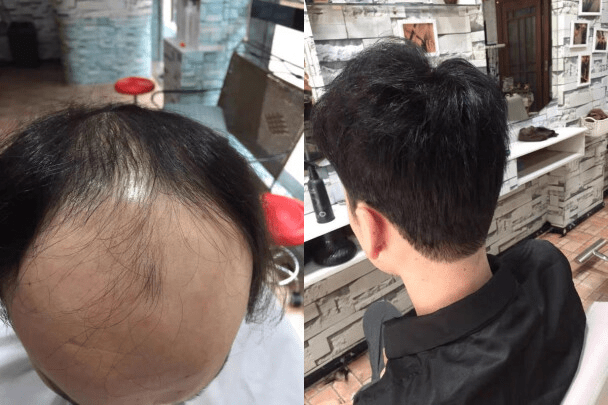 真人发假发定做效果