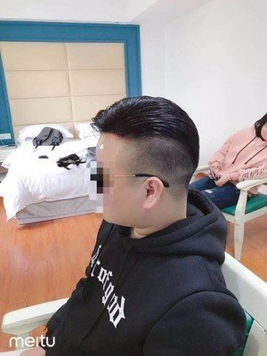 补发后侧面效果 补发后侧面效果