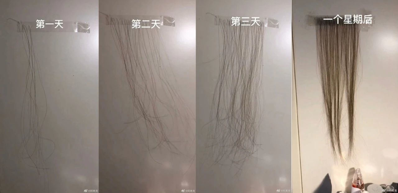 每天掉发量越来越多