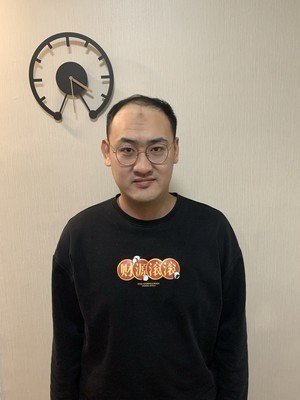 补发前高发际线效果