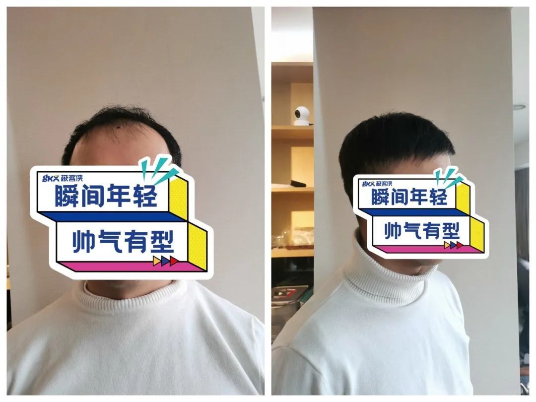 男假发一般多少钱？