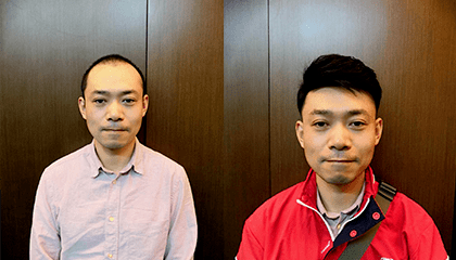 脱发发际线高戴发片效果 脱发发际线高戴发片效果
