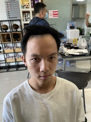 补发前发际线高 补发前发际线高