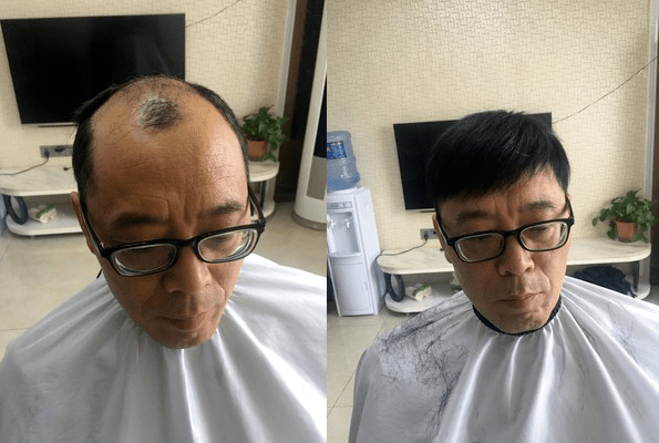 男士假发哪里有卖的？