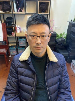 假发补发后效果 假发补发后效果