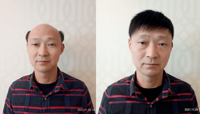 定做一个男士假发要多少钱？