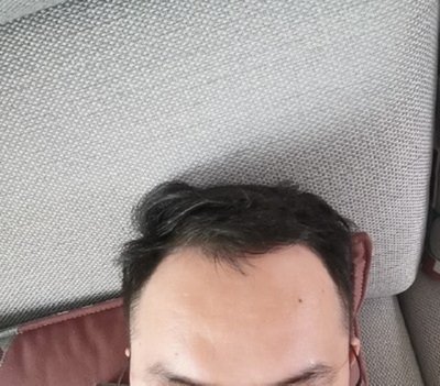 补发前效果