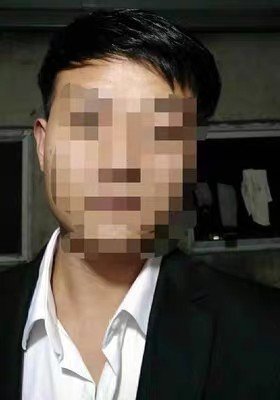 补发后效果 补发后效果