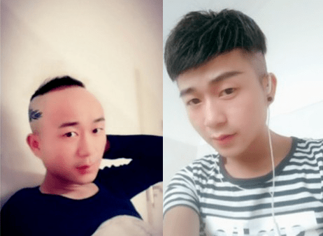 生物头皮是不是假发中ZUI好的技术？