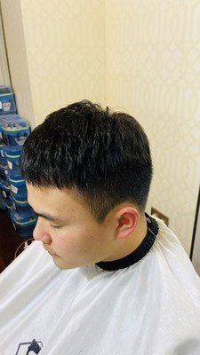 补发后头发浓密效果