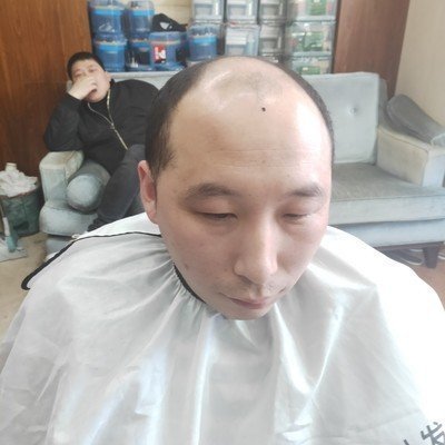 补发前效果