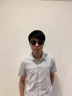 补发后头发浓密显年轻 补发后头发浓密显年轻