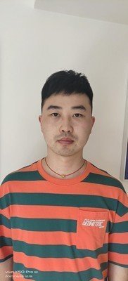 补发后效果：年轻十岁