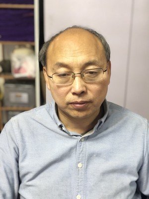 补发前秃顶像六七十岁大爷 补发前秃顶像六七十岁大爷