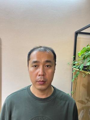 补发前正面效果 补发前正面效果