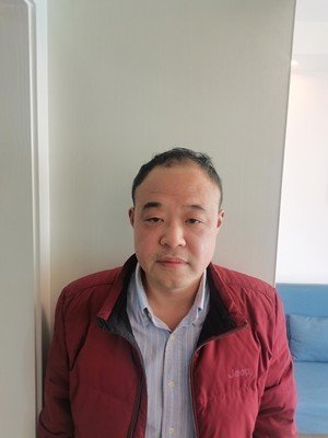 补发前发际线高，头发稀少