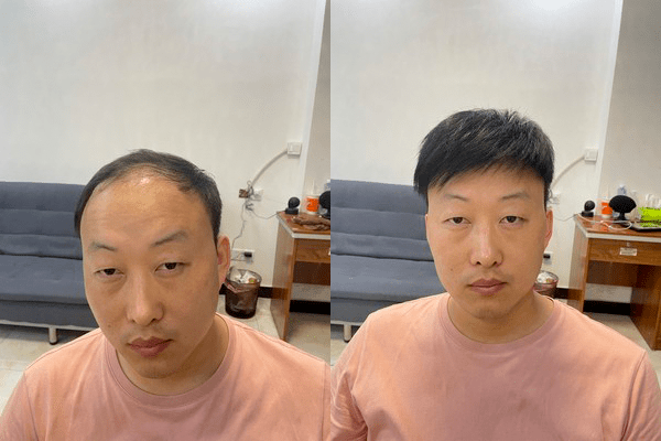 沈阳定制假发哪家好？