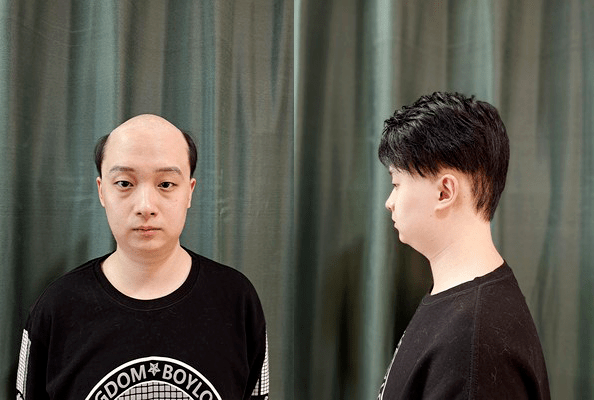 深圳假发定制哪家好？