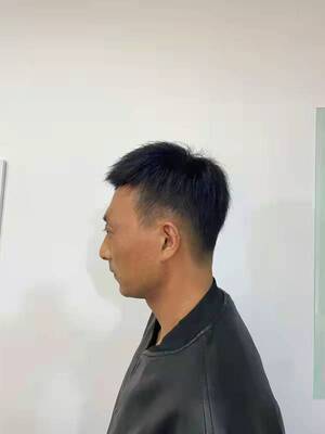 补发后效果 补发后效果