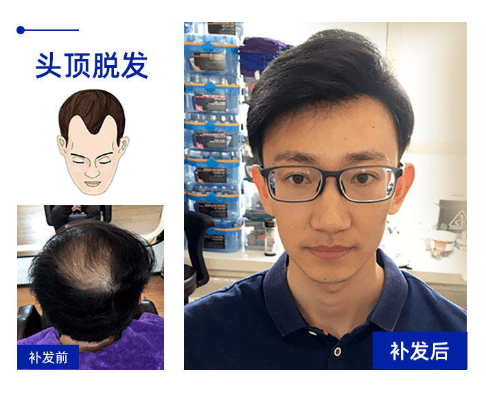 假发去哪里买可以买到正品？