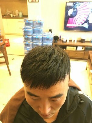补发后效果 补发后效果