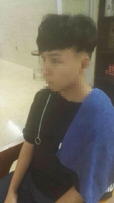 补发后效果