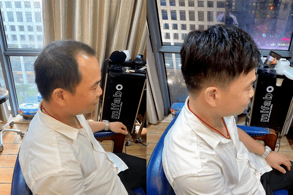 真人发定制假发哪家好？