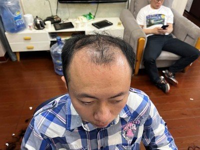 补发前效果 补发前效果