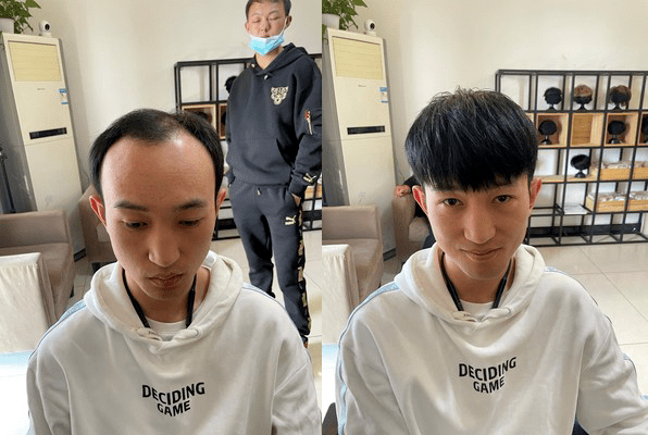 家人们！相亲对象约我第二次见面，该不该告诉她我带了假发