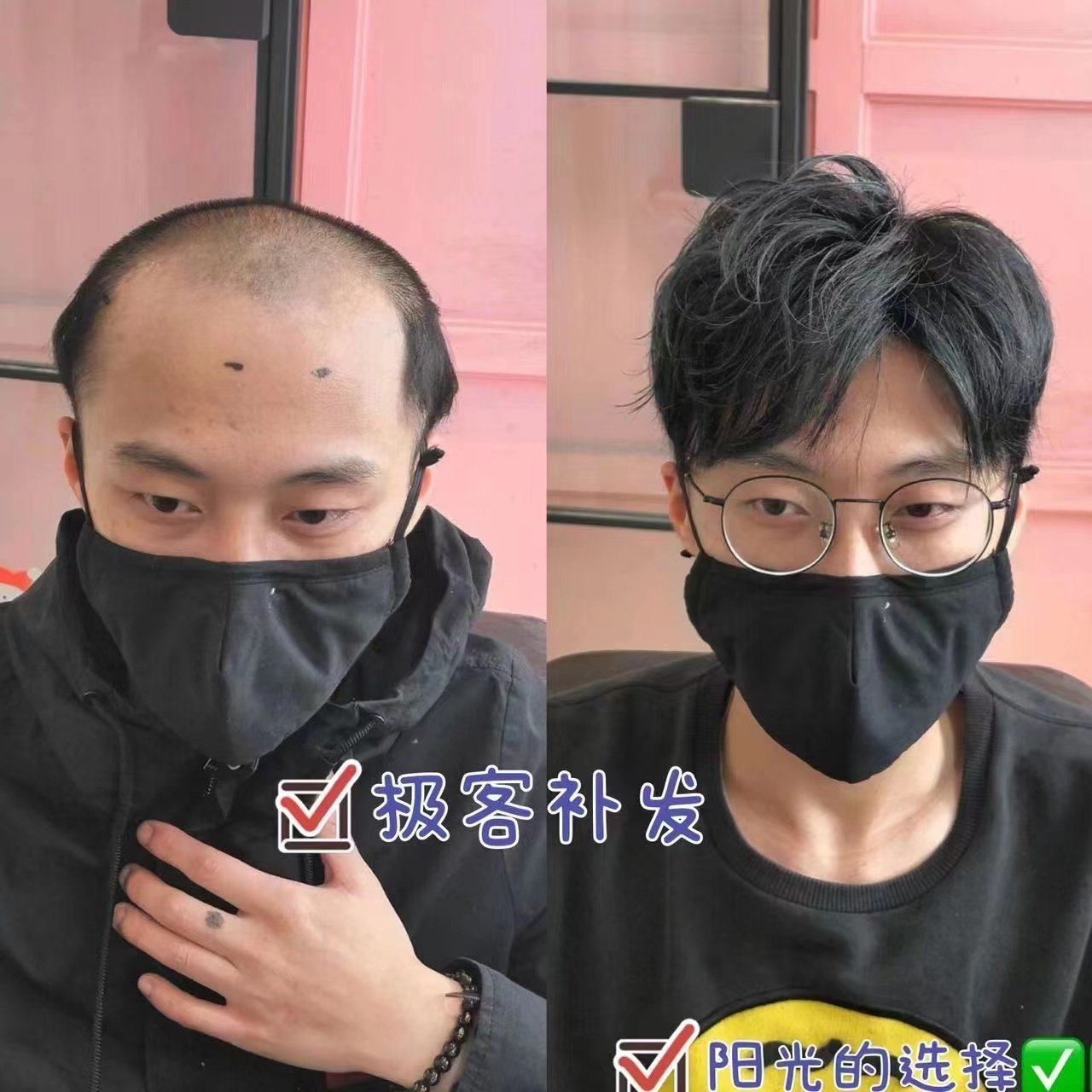 极客侠男士假发佩戴效果 极客侠男士假发佩戴效果