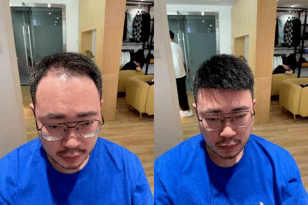 定制假发佩戴效果2 定制假发佩戴效果2