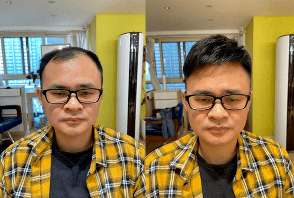 遮掩前额头顶的假发叫什么？