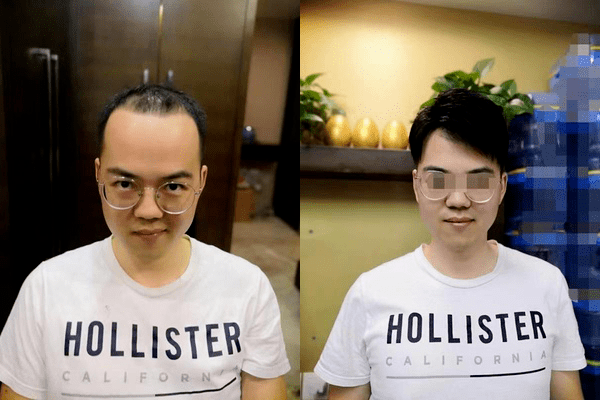 苏州哪里有好一点的假发店？