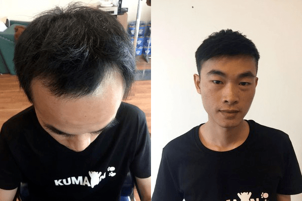 海口哪里有男士假发专卖店？