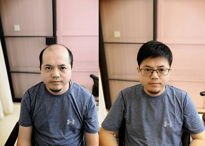 广州哪里卖男士假发？