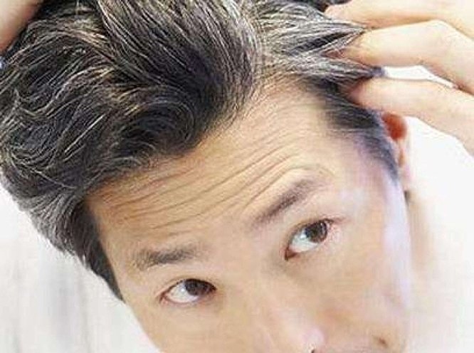 男士白发可以戴假发吗？