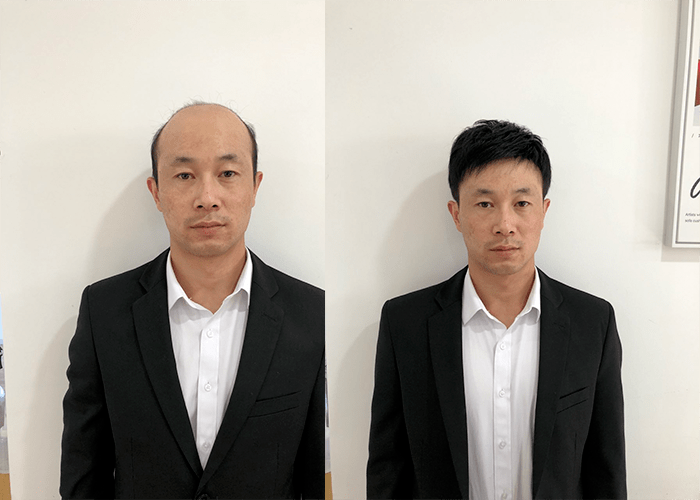 整体头发少秃头戴什么假发？