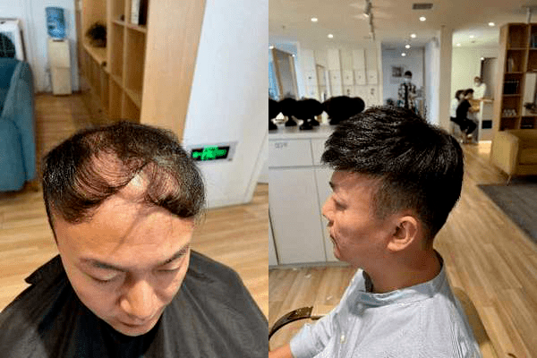 男生戴假发效果 男生戴假发效果