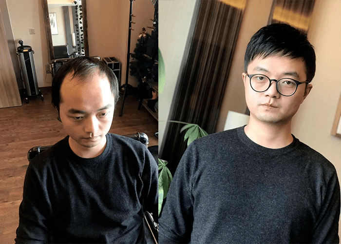 男生可以戴假发吗？