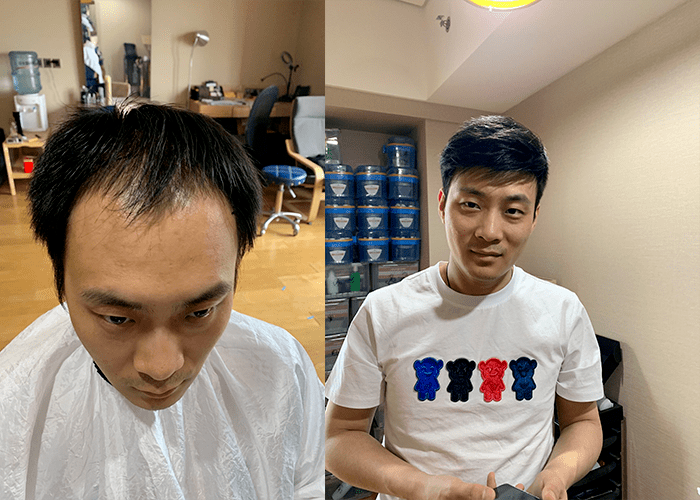 上海纳米假发定制价格高吗？