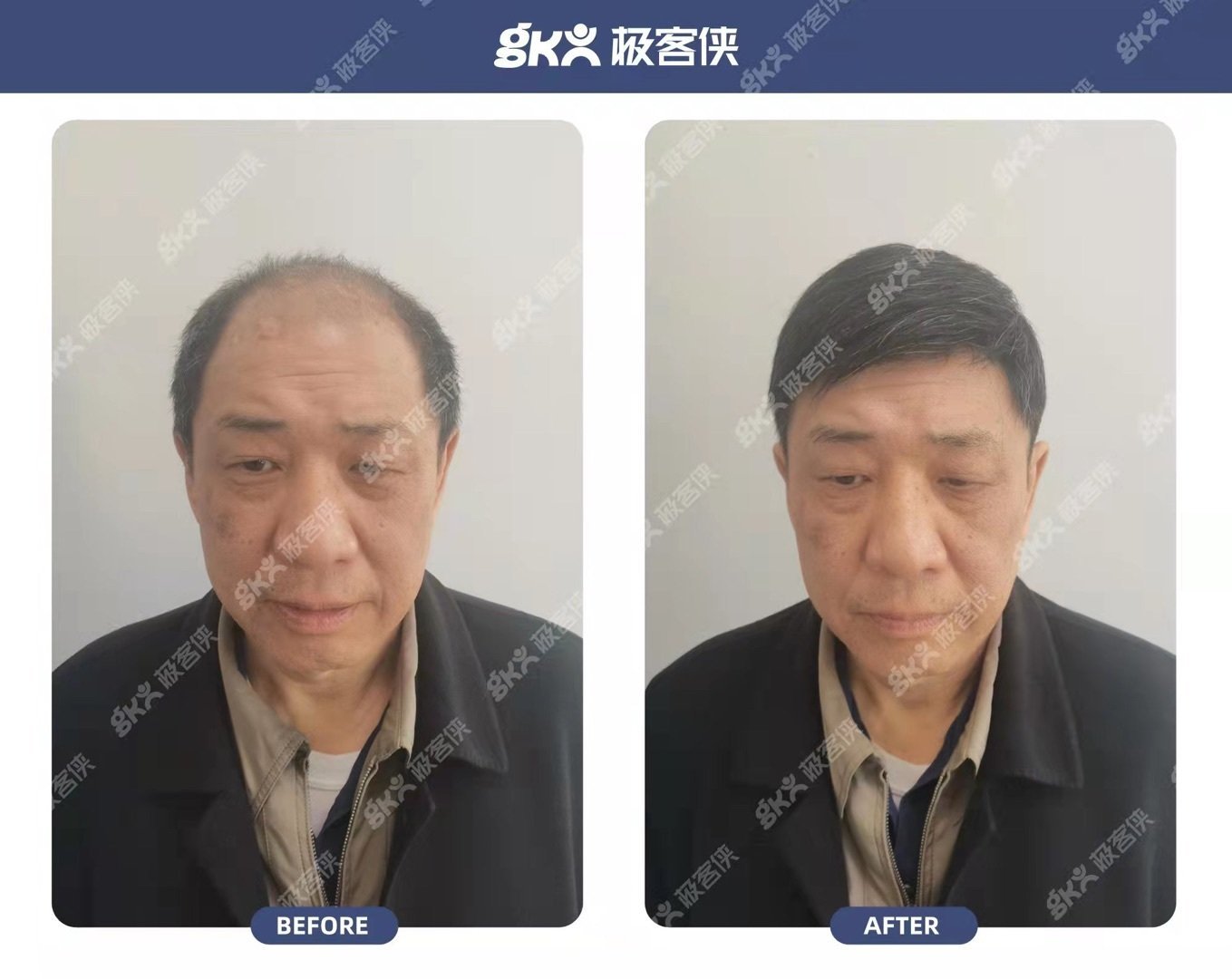 极客侠老年假发效果 极客侠老年假发效果