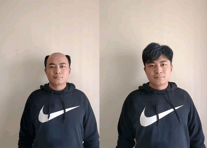 假发是定制还是现买好？