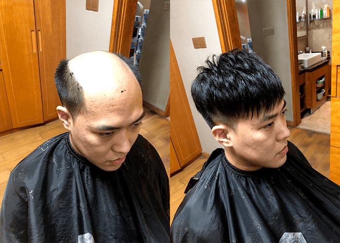 可以粘在头皮上的假发哪里有卖的？