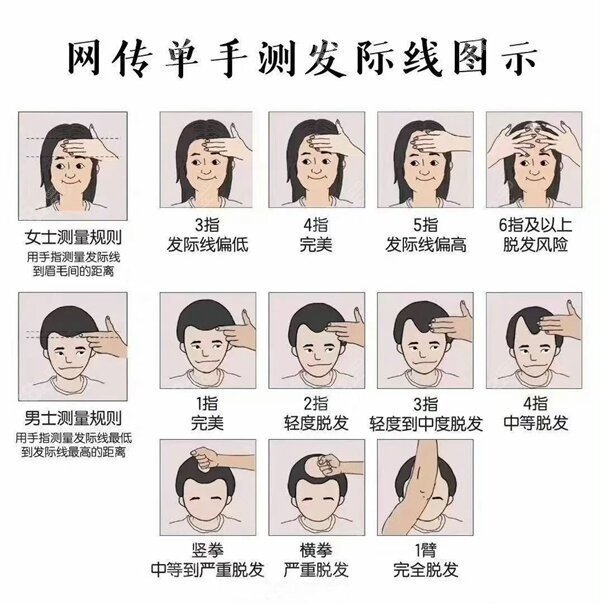 发际线测试 发际线测试