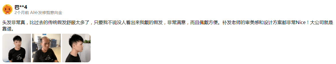 比过去的传统假发舒服太多了 比过去的传统假发舒服太多了