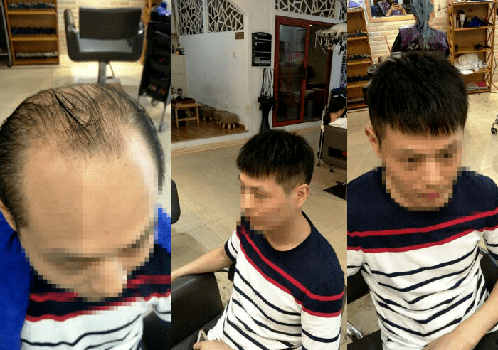 解决了掉发的烦恼，出来的效果很喜欢