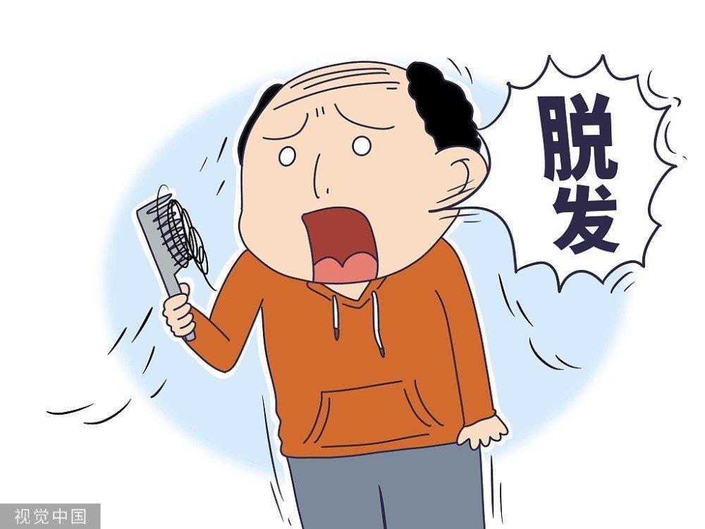 脱发挂什么科室？