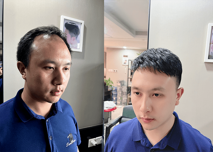 郑州假发定制哪家好？
