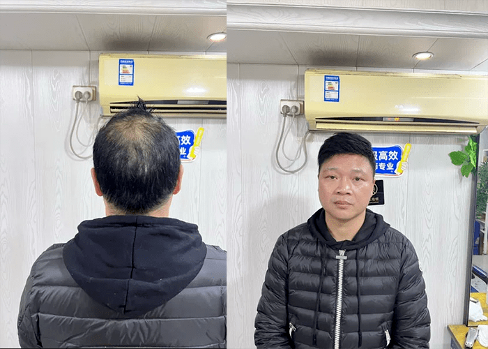 戴着很舒适、很透气,不会有任何不适感 戴着很舒适、很透气,不会有任何不适感