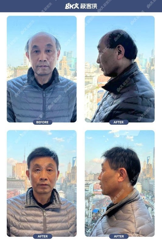 假发片头顶遮白发效果